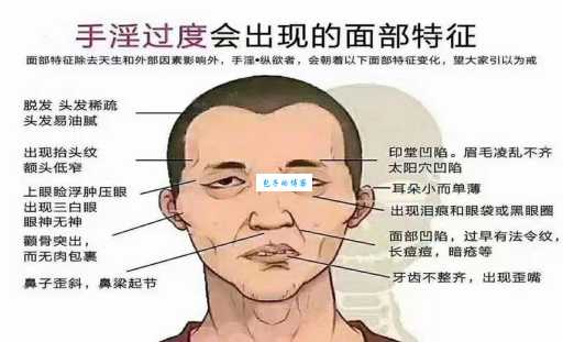 肾虚公子是什么意思?详解肾虚公子的常见表现!