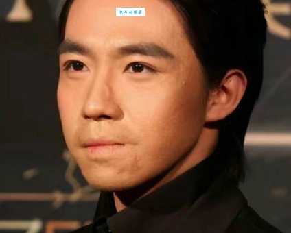 揭秘俞灏明烧伤原因:意外还是人为失误?
