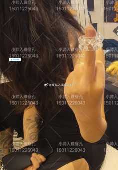 入珠是什么?揭秘入珠手术的真相及潜在风险