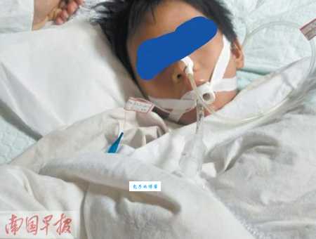 昏迷不醒的意思和症状有哪些快来看看吧