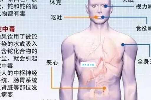 硝酸铊中毒症状有哪些 早期发现和治疗很关键