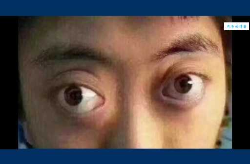 死鱼眼是什么样子的为什么有人会有这种眼神