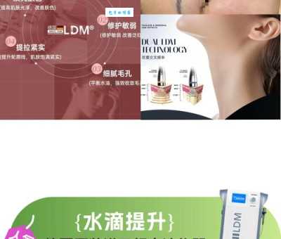 ldm是什么意思 新手必看的ldm基础知识