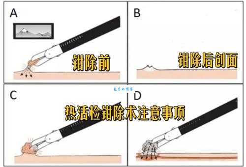 术术是什么意思 教你快速理解术术这个词