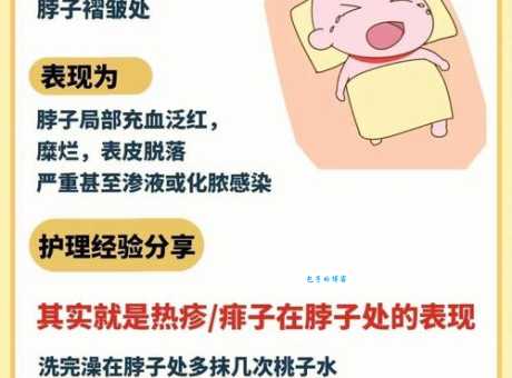 小孩长痱子怎么办 这些方法快速缓解痱子不适