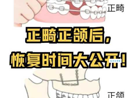 还在纠结颌怎么读 这方法让你轻松读对