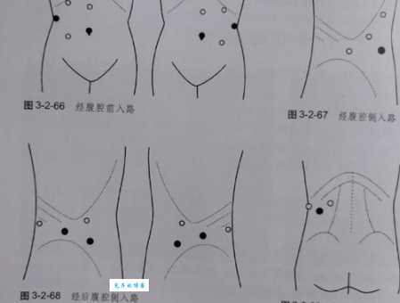 abdomen是什么意思？教你正确理解医学术语中的腹部！