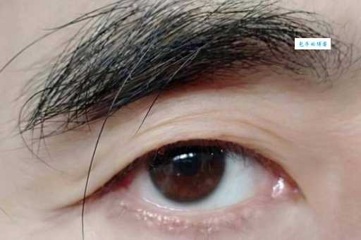 眉毛中有一根长毛代表什么意思？这几种情况要注意！