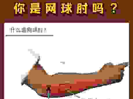 深度解析臂有四肘的意思到底指向哪个典故