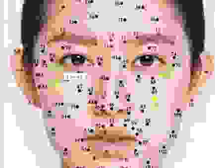 黑痣的意思是什么?解析面部不同位置黑痣的含义