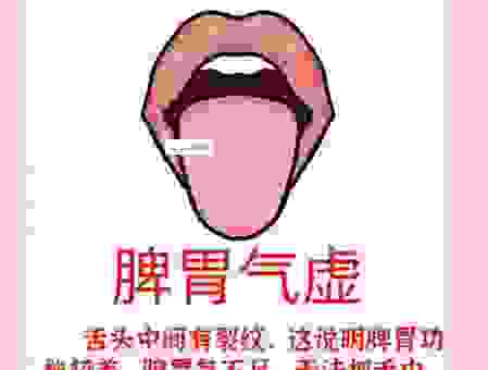 关于舌锋如火的意思，这几个解释最清晰简单
